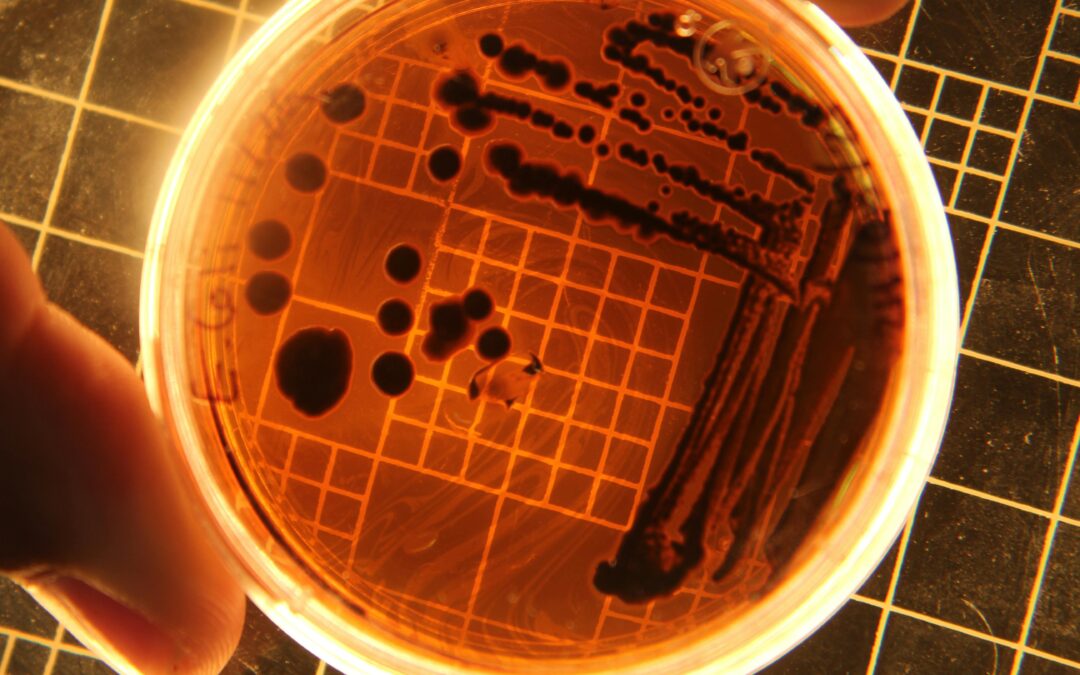 Helicobacter pylori: qué es, síntomas, diagnóstico y tratamiento